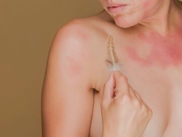 Imagen de archivo de una persona padeciendo alergia a una pluma