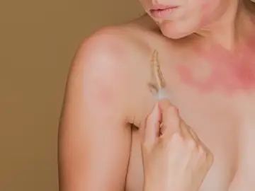 Imagen de archivo de una persona padeciendo alergia a una pluma Imagen de archivo de una persona padeciendo alergia a una pluma