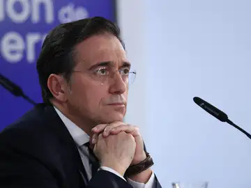 Albares cree que "no tendría ningún sentido" que Trump emprendiera acciones contra España: "Sería un mundo al revés" Albares cree que "no tendría ningún sentido" que Trump emprendiera acciones contra España: "Sería un mundo al revés"