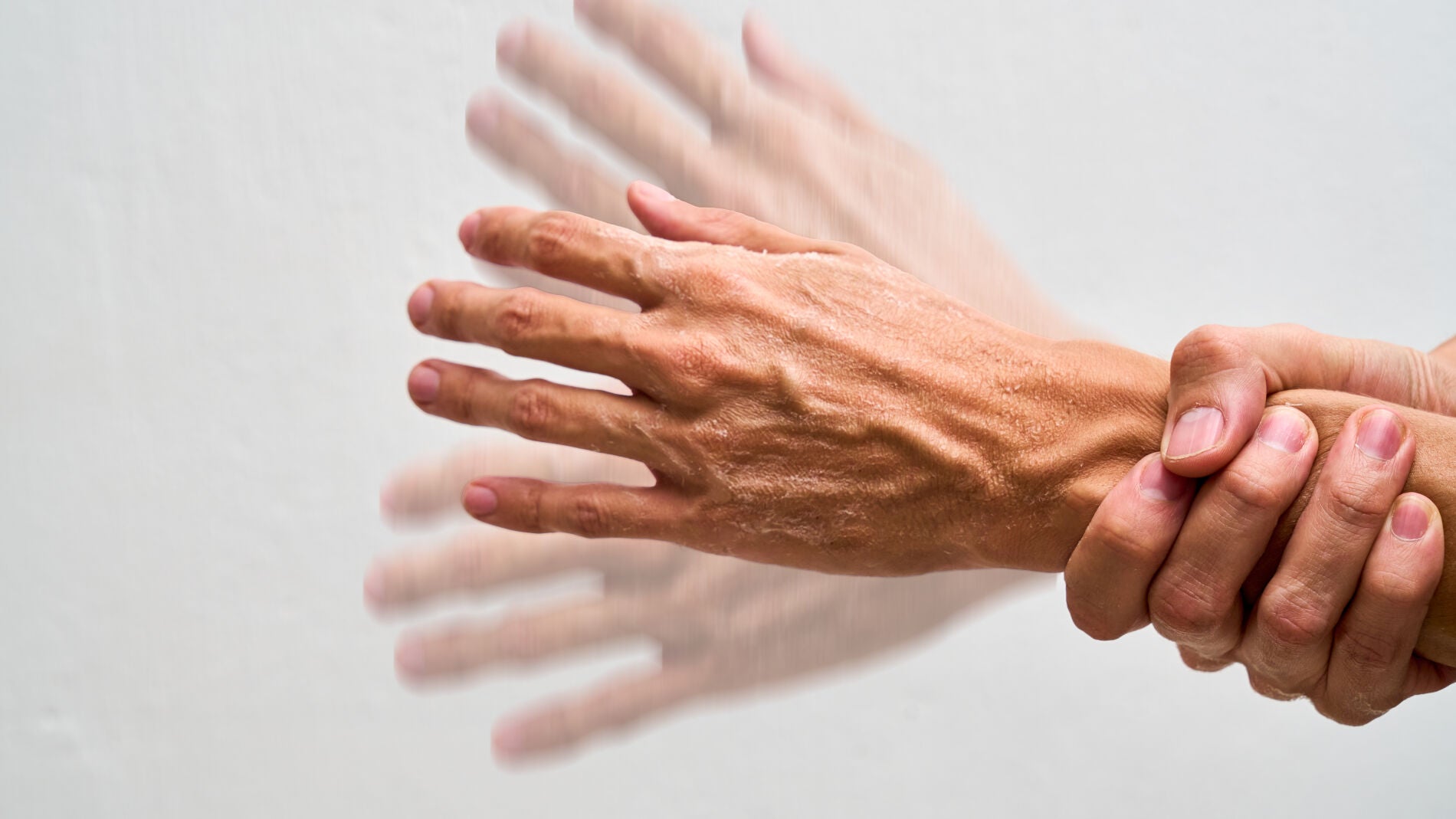 Los temblores en las manos no siempre indican párkinson