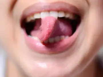 La capacidad no es genética: nadie en mi familia, excepto yo, es capaz de girar la lengua de este modo. Anatomía