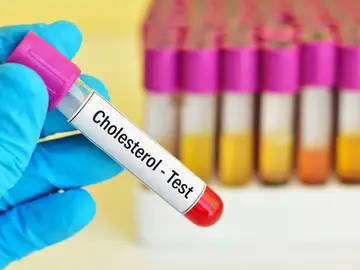 Una nutricionista asegura que se le tiene miedo al colesterol y que eso es "un problema muy grande" en la alimentación Una nutricionista asegura que se le tiene miedo al colesterol y que eso es "un problema muy grande" en la alimentación