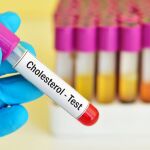 Una nutricionista asegura que se le tiene miedo al colesterol y que eso es "un problema muy grande" en la alimentaci&oacute;n