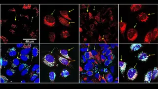 Una nueva estrategia frente al cáncer consigue 'in vitro' mayor muerte celular con menos quimioterapia En rojo, el fármaco después del tratamiento térmico se dispersa por la célula y alcanza el núcleo (en azul). REMITIDA / HANDOUT por ICMM Fotografía remitida a medios de comunicación exclusivamente para ilustrar la noticia a la que hace referencia la imagen, y citando la procedencia de la imagen en la firma 24/03/2026