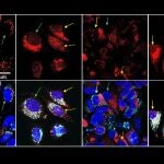 Una nueva estrategia frente al c&aacute;ncer consigue 'in vitro' mayor muerte celular con menos quimioterapia