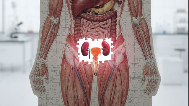 Trasplante de vejiga