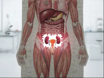 Trasplante de vejiga Trasplante de vejiga