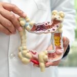 Experto destaca el papel de la alimentaci&oacute;n y el estilo de vida saludable en la prevenci&oacute;n del c&aacute;ncer de colon