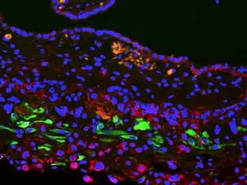En naranja las nuecas células descubiertas Embarazo