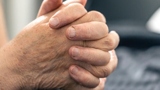 Identifican una mol&eacute;cula que frena la artritis reumatoide en sus primeras fases