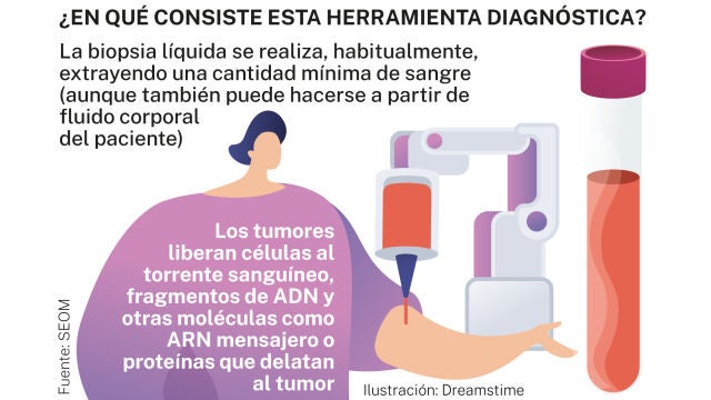 Biopsia con sangre o fluido corporal
