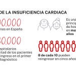 Insuficiencia cardiaca