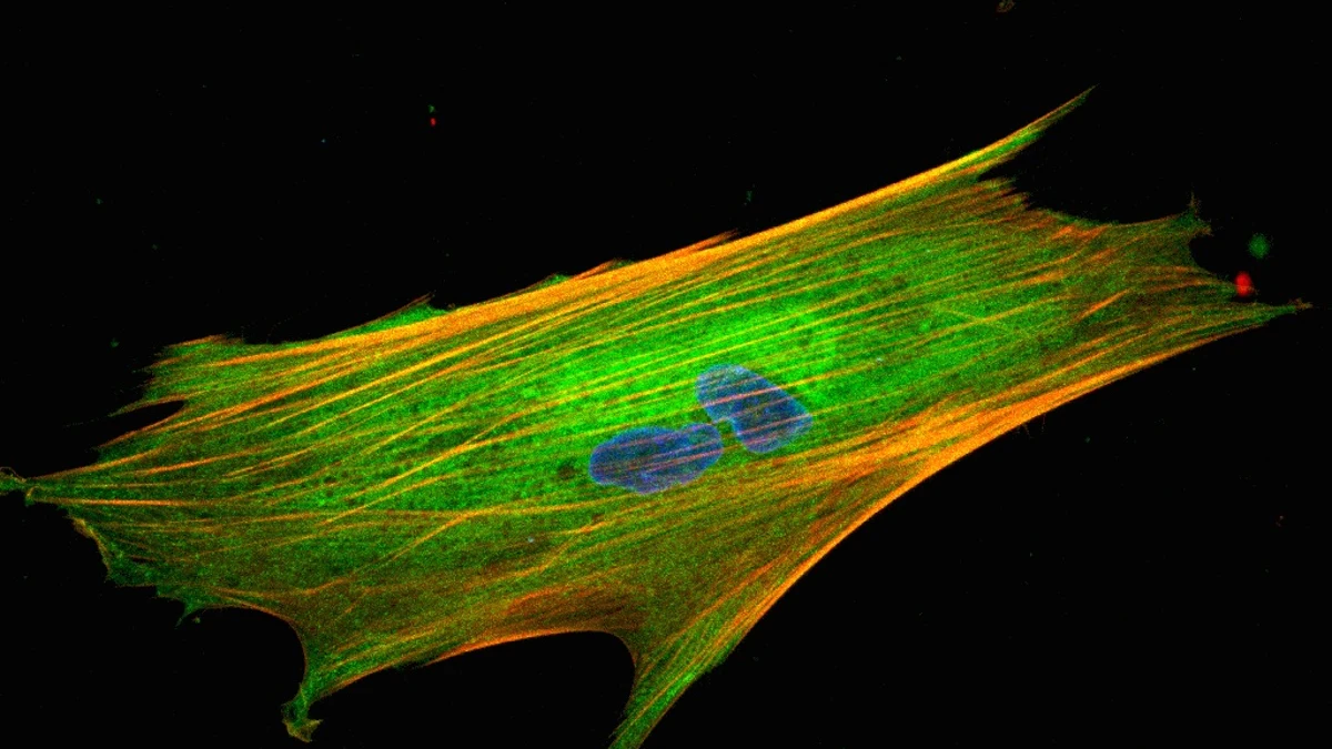 imagen de microscopio de las células de cáncer de páncreas donde se visualiza el ADN y cGAS (verde), un sensor del sistema inmunitario