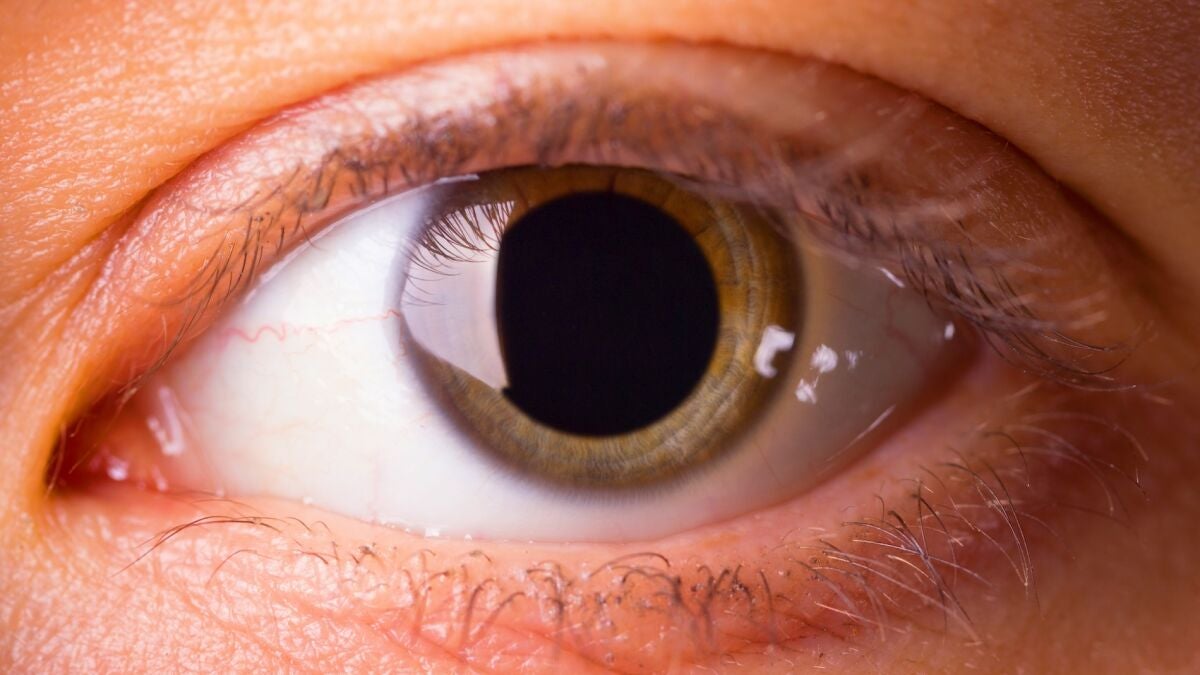 Brown University Finds Why Pupils Dilate When Surprised