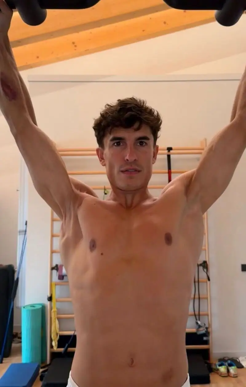 Marc ha mostrado cómo está su brazo derecho