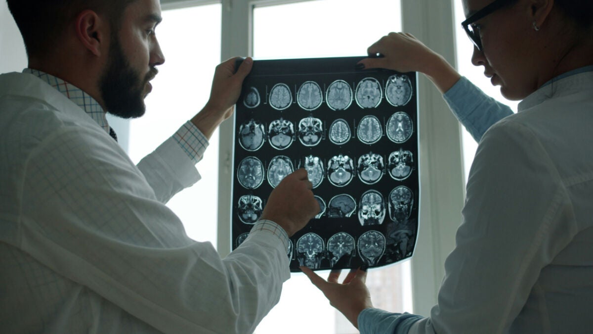 Brain aging begins decades before symptoms, UCLA study finds